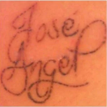 Mismo tatuaje de letras 'José Ángel' con la tinta muy aclarada tras 3 sesiones de láser